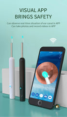 NATFIRE NE7 Smart Visual Ear Sticks Otoscope 1296P Endoscope Wax Removal Tool Earpick Mini Camera Health Care Ear Cleaner