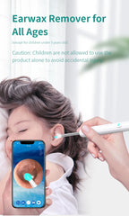 NATFIRE NE7 Smart Visual Ear Sticks Otoscope 1296P Endoscope Wax Removal Tool Earpick Mini Camera Health Care Ear Cleaner